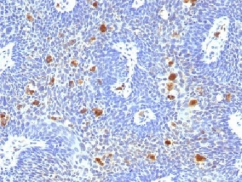 Anti HPV16 E6 Antibody Mouse Anti Human Papillomavirus IHC LSBio