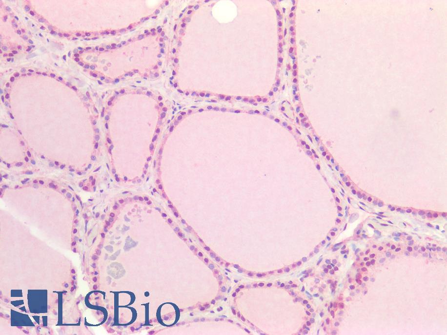 IHC Plus CD118 LIF Receptor Alpha Polyclonal Antibody Rabbit LSBio