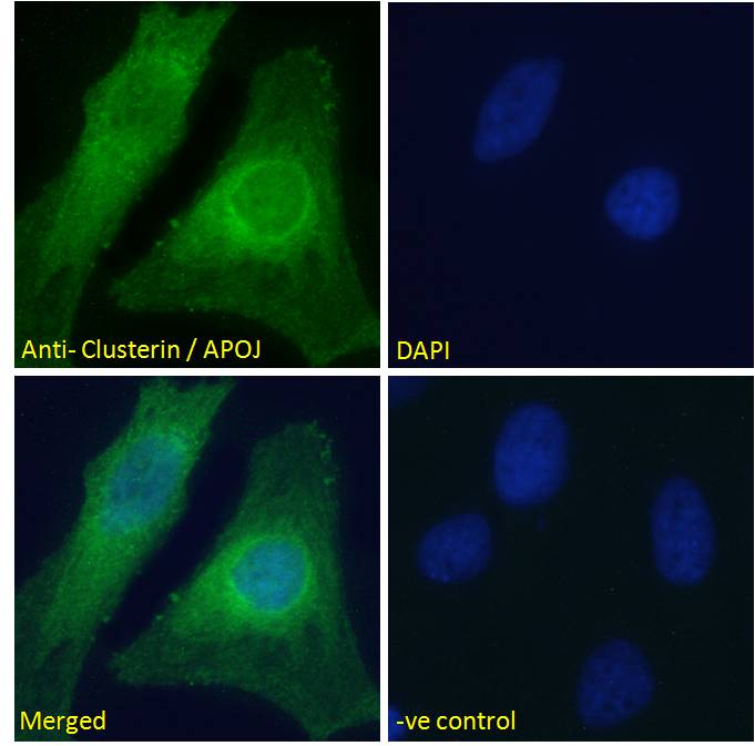 IHC Plus CLU Clusterin Polyclonal Antibody Goat Anti Human LSBio