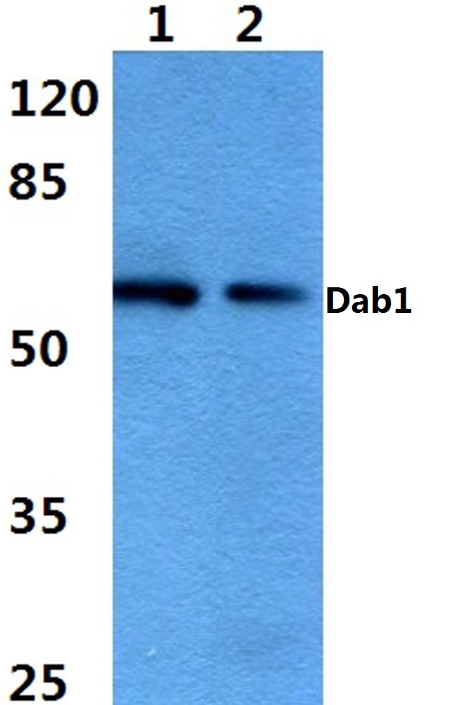 Ihc Plus Dab Polyclonal Antibody Rabbit Anti Human If Ihc Wb Lsbio