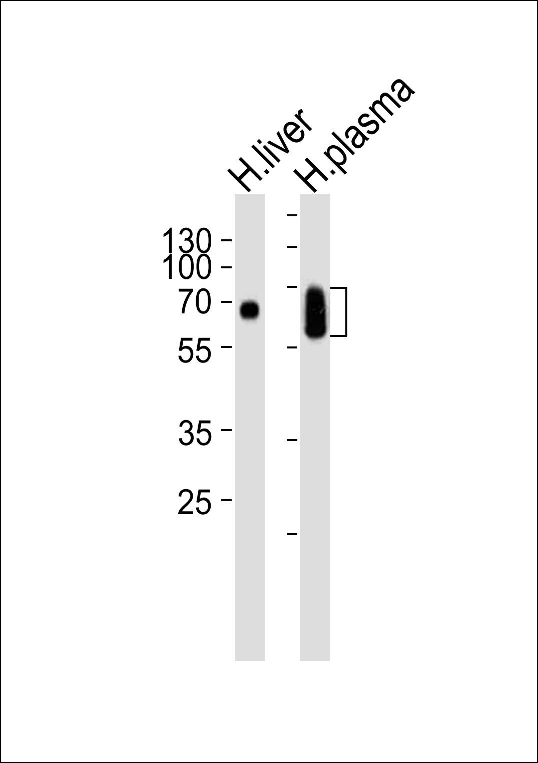 Anti Lp Pla Pla G Antibody Rabbit Anti Human Polyclonal Lsbio