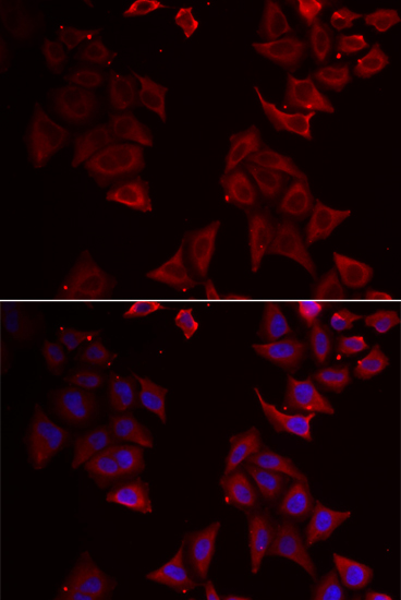 Anti NCR1 NKP46 Antibody Rabbit Anti Human Polyclonal IF IHC WB LSBio