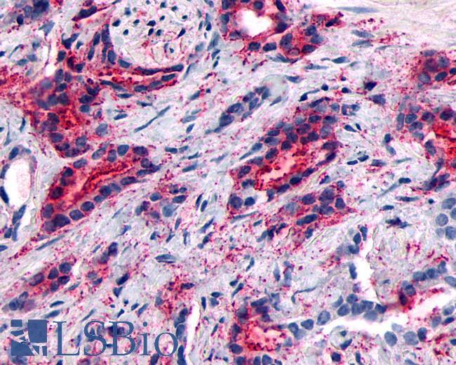 Pathplus Gpr A Polyclonal Antibody Rabbit Anti Human Ihc Lsbio