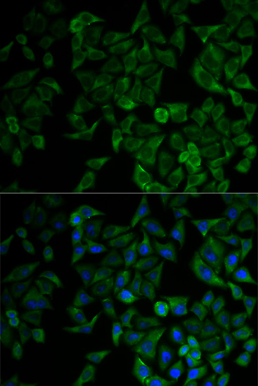 Anti Tnfrsf A Tnfr Antibody Rabbit Anti Human Polyclonal Lsbio