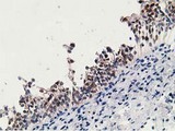 15-PGDH / HPGD Antibody - IHC of paraffin-embedded Human bladder tissue using anti-HPGD mouse monoclonal antibody.