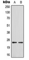 5-Alpha Reductase / SRD5A1 Antibody - Western blot analysis of SRD5A1 expression in HEK293T (A); H9C2 (B) whole cell lysates.