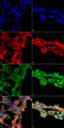 7-Ketocholesterol Antibody - Immunocytochemistry/Immunofluorescence analysis using Mouse Anti-7-Ketocholesterol Monoclonal Antibody, Clone 7E1. Tissue: Embryonic kidney epithelial cell line (HEK293). Species: Human. Fixation: 5% Formaldehyde for 5 min. Primary Antibody: Mouse Anti-7-Ketocholesterol Monoclonal Antibody at 1:50 for 30-60 min at RT. Secondary Antibody: Goat Anti-Mouse Alexa Fluor 488 at 1:1500 for 30-60 min at RT. Counterstain: Phalloidin Alexa Fluor 633 F-Actin stain; DAPI (blue) nuclear stain at 1:250, 1:50000 for 30-60 min at RT. Magnification: 20X (2X Zoom). (A,C,E,G) - Untreated. (B,D,F,H) - Cells cultured overnight with 50 µM H2O2. (A,B) DAPI (blue) nuclear stain. (C,D) Phalloidin Alexa Fluor 633 F-Actin stain. (E,F) 7-Ketocholesterol Antibody. (G,H) Composite. Courtesy of: Dr. Robert Burke, University of Victoria.