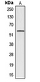 A1BG Antibody - Western blot analysis of Alpha 1B glycoprotein expression in MCF7 (A) whole cell lysates.