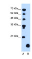 A4 / PLP2 Antibody - PLP2 antibody ARP45348_T100-NP_002659-PLP2(proteolipid protein 2 (colonic epithelium-enriched)) Antibody Western blot of HepG2 cell lysate.  This image was taken for the unconjugated form of this product. Other forms have not been tested.