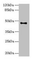 AADACL2 Antibody - Western blot All lanes: AADACL2 antibody at 2µg/ml + PC-3 whole cell lysate Secondary Goat polyclonal to rabbit IgG at 1/10000 dilution Predicted band size: 47, 6 kDa Observed band size: 47 kDa