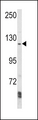 AAK1 Antibody - Western blot of AAK1 Antibody in Ramos cell line lysates (35 ug/lane). AAK1 (arrow) was detected using the purified antibody.