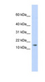 AAMDC Antibody - C11orf67 antibody Western blot of Placenta lysate. This image was taken for the unconjugated form of this product. Other forms have not been tested.