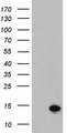 AAMDC Antibody - HEK293T cells were transfected with the pCMV6-ENTRY control (Left lane) or pCMV6-ENTRY C11orf67 (Right lane) cDNA for 48 hrs and lysed. Equivalent amounts of cell lysates (5 ug per lane) were separated by SDS-PAGE and immunoblotted with anti-C11orf67.