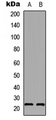 AANAT Antibody - Western blot analysis of AANAT expression in A549 (A); PC12 (B) whole cell lysates.
