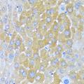 AARS Antibody - Immunohistochemistry of paraffin-embedded Mouse liver using AARS Polyclonal Antibody at dilution of 1:100 (40x lens).