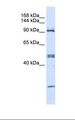 AARS Antibody - 293T cell lysate. Antibody concentration: 1.0 ug/ml. Gel concentration: 6-18%.  This image was taken for the unconjugated form of this product. Other forms have not been tested.