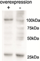AARS2 Antibody - AARS2 antibody Cell line 143B overexpressing Human AARS2 and probed with (mock transfection in second lane). Data obtained from Henna.Tyynismaa, University of Helsinki, Finland.