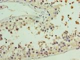 AASDHPPT / LYS5 Antibody - Immunohistochemistry of paraffin-embedded human testis using antibody at 1:100 dilution.  This image was taken for the unconjugated form of this product. Other forms have not been tested.