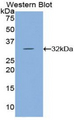 AATK / AATYK Antibody - Western blot of recombinant AATK / AATYK.  This image was taken for the unconjugated form of this product. Other forms have not been tested.