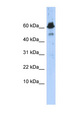 ABAT Antibody - ABAT antibody Western blot of Transfected 293T cell lysate. This image was taken for the unconjugated form of this product. Other forms have not been tested.
