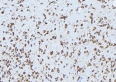 ABCA3 Antibody - 1:100 staining mouse brain tissue by IHC-P. The sample was formaldehyde fixed and a heat mediated antigen retrieval step in citrate buffer was performed. The sample was then blocked and incubated with the antibody for 1.5 hours at 22°C. An HRP conjugated goat anti-rabbit antibody was used as the secondary.