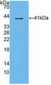 ABCA4 Antibody - Western Blot; Sample: Recombinant ABCA4, Human.