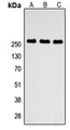 ABCA4 Antibody - Western blot analysis of ABCA4 expression in HEK293T (A); NS-1 (B); PC12 (C) whole cell lysates.
