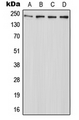 ABCA7 Antibody - Western blot analysis of ABCA7 expression in HeLa (A); Raw264.7 (B); mouse liver (C); PC12 (D) whole cell lysates.