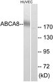 ABCA8 Antibody - Western blot analysis of lysates from HUVEC cells, using ABCA8 Antibody. The lane on the right is blocked with the synthesized peptide.