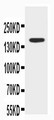 ABCB4 / MDR3 Antibody - WB of ABCB4 / MDR3 antibody. WB: MCF-7 Cell Lysate.
