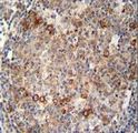 ABCC10 Antibody - ABCC10 antibody immunohistochemistry of formalin-fixed and paraffin-embedded human tonsil tissue followed by peroxidase-conjugated secondary antibody and DAB staining.