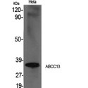 ABCC13 Antibody - Western blot of ABCC13 antibody