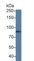 ABCC4 / MRP4 Antibody - Western Blot; Sample: Human Serum; Primary Ab: 1µg/ml Rabbit Anti-Human ABCC4 Antibody Second Ab: 0.2µg/mL HRP-Linked Caprine Anti-Rabbit IgG Polyclonal Antibody