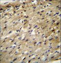 ABCD2 / ALDR Antibody - ABCD2 Antibody immunohistochemistry of formalin-fixed and paraffin-embedded human heart tissue followed by peroxidase-conjugated secondary antibody and DAB staining.