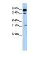 ABCD4 Antibody - ABCD4 antibody Western blot of 721_B cell lysate. This image was taken for the unconjugated form of this product. Other forms have not been tested.