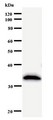 ABCF2 Antibody - Western blot of immunized recombinant protein using ABCF2 antibody.