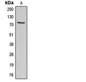 ABCG1 Antibody - Western blot analysis of ABCG1 expression in HepG2 (A) whole cell lysates.
