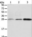ABH2 / ALKBH2 Antibody - Western blot analysis of Human fetal liver and seminoma tissue, RAW264.7 cell, using ALKBH2 Polyclonal Antibody at dilution of 1:650.