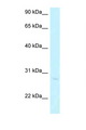 ABHD12B Antibody - ABHD12B antibody Western blot of Jurkat Cell lysate. Antibody concentration 1 ug/ml.  This image was taken for the unconjugated form of this product. Other forms have not been tested.