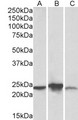 ABHD14B Antibody - Goat Anti-ABHD14B (aa188-200) Antibody (0.3µg/ml) staining of Human (A), Mouse(B), Rat (C) Liver lysate (35µg protein in RIPA buffer). Primary incubation was 1 hour. Detected by chemiluminescencence.