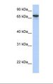 ABHD16A / BAT5 Antibody - HepG2 cell lysate. Antibody concentration: 1.0 ug/ml. Gel concentration: 12%.  This image was taken for the unconjugated form of this product. Other forms have not been tested.