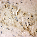 ABI1 / SSH3BP1 Antibody - IHC analysis of ABI using anti-ABI antibody. ABI was detected in paraffin-embedded section of rat brain tissues. Heat mediated antigen retrieval was performed in citrate buffer (pH6, epitope retrieval solution) for 20 mins. The tissue section was blocked with 10% goat serum. The tissue section was then incubated with 1µg/ml rabbit anti-ABI Antibody overnight at 4°C. Biotinylated goat anti-rabbit IgG was used as secondary antibody and incubated for 30 minutes at 37°C. The tissue section was developed using Strepavidin-Biotin-Complex (SABC) with DAB as the chromogen.