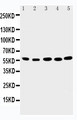 ABI2B / ABI2 Antibody - WB of ABI2B / ABI2 antibody. Lane 1: Rat Brain Tissue Lysate. Lane 2: Human Placenta Tissue Lysate. Lane 3: MCF-7 Cell Lysate. Lane 4: HELA Cell Lysate. Lane 5: JURKAT Cell Lysate.