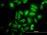 ABL2 Antibody - Immunofluorescence of monoclonal antibody to ABL2 on HeLa cell (antibody concentration 10 ug/ml).