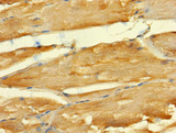 ABLIM2 Antibody - Immunohistochemistry of paraffin-embedded human skeletal muscle tissue using ABLIM2 Antibody at dilution of 1:100