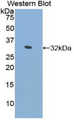 ABP-280 / FLNC Antibody - Western blot of recombinant ABP-280 / FLNC.