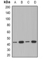 ACAA1 Antibody - Western blot analysis of ACAA1 expression in A549 (A); Jurkat (B); mouse kidney (C); rat liver (D) whole cell lysates.
