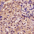 ACAA1 Antibody - Immunohistochemical analysis of ACAA1 staining in rat kidney formalin fixed paraffin embedded tissue section. The section was pre-treated using heat mediated antigen retrieval with sodium citrate buffer (pH 6.0). The section was then incubated with the antibody at room temperature and detected using an HRP conjugated compact polymer system. DAB was used as the chromogen. The section was then counterstained with hematoxylin and mounted with DPX.