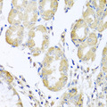 ACAD9 Antibody - Immunohistochemistry of paraffin-embedded human stomach tissue.