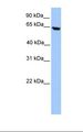 ACADVL Antibody - HepG2 cell lysate. Antibody concentration: 1.17 ug/ml. Gel concentration: 12%.  This image was taken for the unconjugated form of this product. Other forms have not been tested.